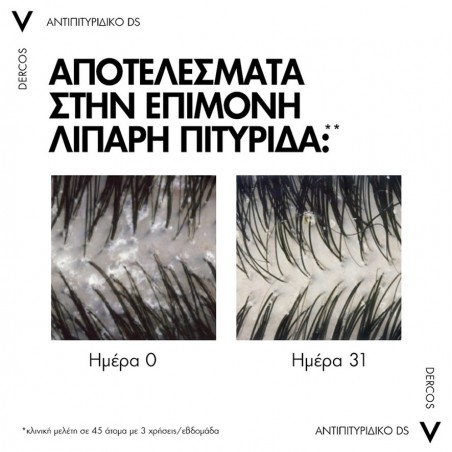 VICHY Dercos Anti-Dandruff DS Σαμπουάν κατά της Πιτυρίδας & του Κνησμού για Κανονικά - Λιπαρά Μαλλιά, 200ml