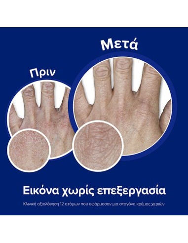 NEUTROGENA Box Hand & Nail Κρέμα Χεριών &...